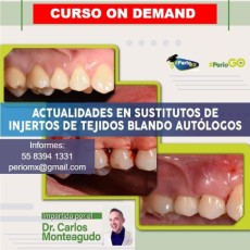 Actualidades en sustitutos de ingertos de tejido blando autologos $USD 
